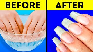 26 AWESOME NAIL HACKS YOU WILL DEFINITELY LIKE [upl. by Orms45]