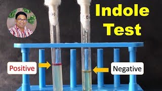 Bacterial Identification Tests Indole Test [upl. by Selda316]