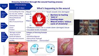 Understanding Wound Dressings Categories and Indications [upl. by Yrbua]