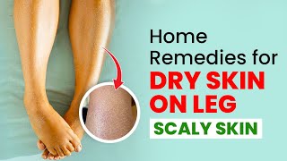 Dry Skin Solutions Easy Home Remedies for Legs [upl. by Merta]