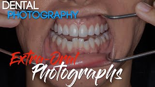 Dental Photography Basics  Dental Photography Techniques  Extraoral Photographs [upl. by Yelnet]