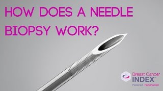 How Does a Needle Biopsy Work [upl. by Uile966]