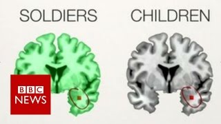 The PTSD brains of children amp soldiers  BBC News [upl. by Zielsdorf]