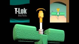 TLok Bone Marrow Biopsy System Procedure Video [upl. by Donoghue]