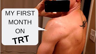 My First Month on TRT  Testosterone Replacement Therapy [upl. by Anetsirk]