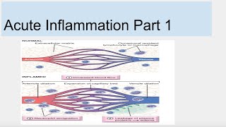 Acute Inflammation Part 1 [upl. by Dorelia841]