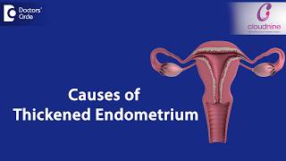 What causes Endometrial thickness  DrSmitha Sha of Cloudnine Hospitals  Doctors Circle [upl. by Halette]