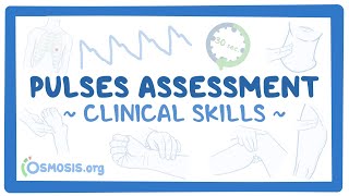 Clinical Skills Pulses assessment [upl. by Meela]