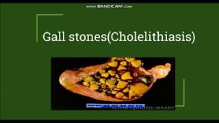 Cholelithiasis  Gallstones Pathogenesis amp Morphology [upl. by Oshinski]