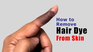 How to remove hair dye from skin  Easy amp Effective Method [upl. by Arney]