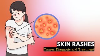 Skin Rash Causes Signs and Symptoms Diagnosis and Treatment [upl. by Fonsie]