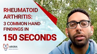 Rheumatoid Arthritis 3 Common Hand Findings in 150 seconds [upl. by Cynthea204]