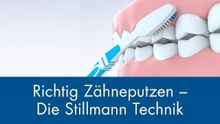 Richtig Zähneputzen  Die Stillmann Technik [upl. by Nomead521]