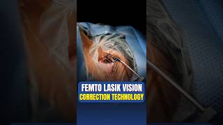 Femto Cataract Removal Surgery by Dr Aamir Asrar [upl. by Rtoip]