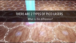 Why Are There Different Types of Pico Laser  Dr Kenneth Thean [upl. by Josie728]