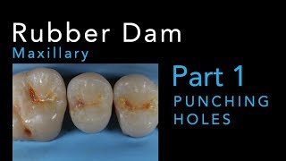 Rubber Dam Isolation Part 1 Punching Maxillary Holes [upl. by Niessuh]