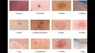 Skin Lesions with defination [upl. by Esir]