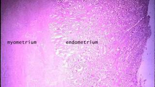 MYOMETRIUM  HEALTH EDUCATION  ICSP  URDU  HINDI [upl. by Lidstone]