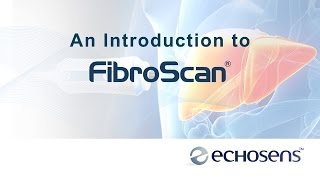 A Patients Introduction to FibroScan [upl. by Frissell207]