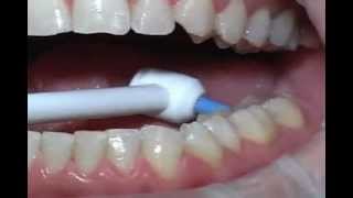 the optimal use of Water Pick [upl. by Somar]