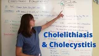 Cholelithiasis amp Cholecystitis [upl. by Aicilec335]